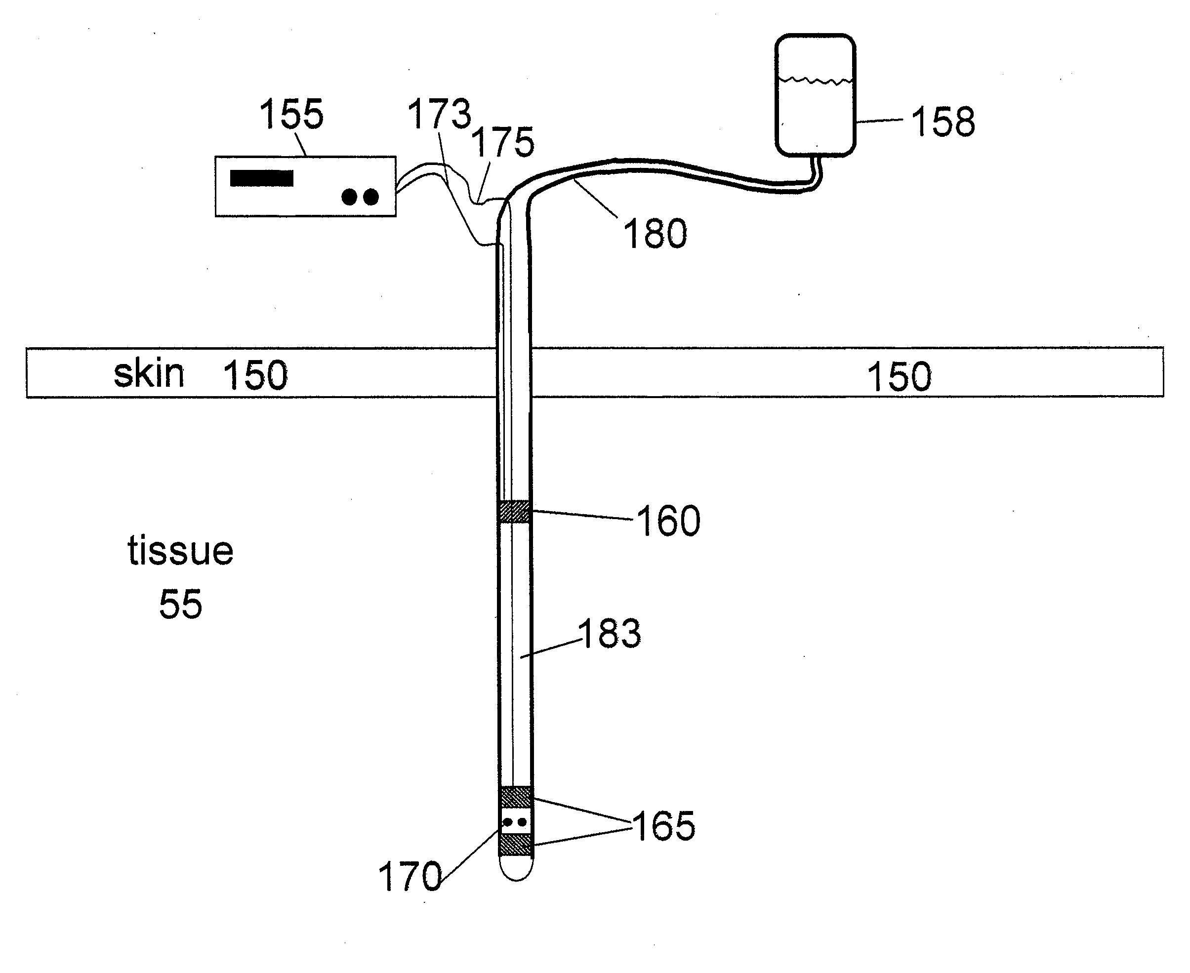 Use of electric fields to minimize rejection of implanted devices and materials