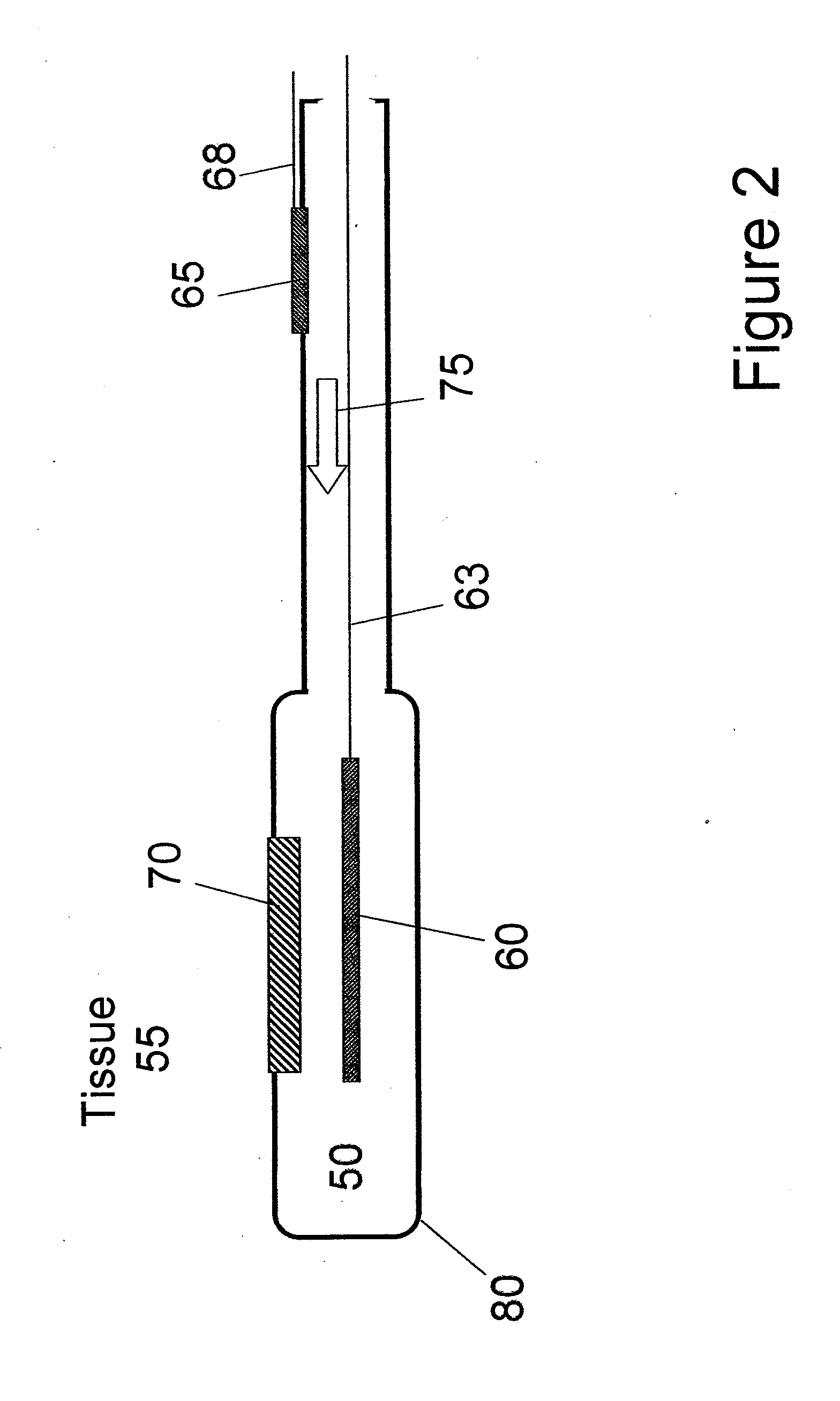 Use of electric fields to minimize rejection of implanted devices and materials