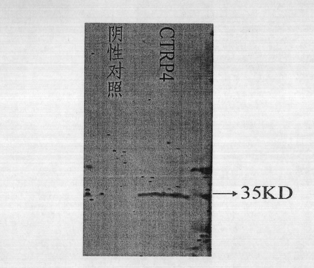 Human CTRP4 gene, its coding protein and their application