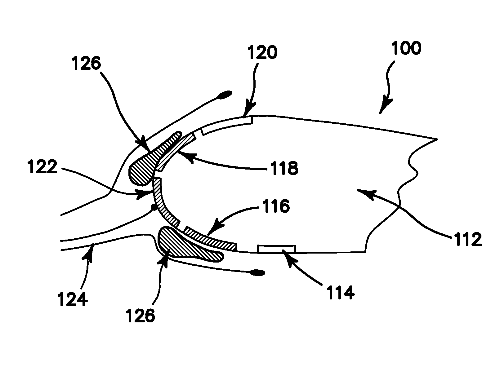 Anti-icing, de-icing, and heating configuration, integration, and power methods for aircraft, aerodynamic, and complex surfaces