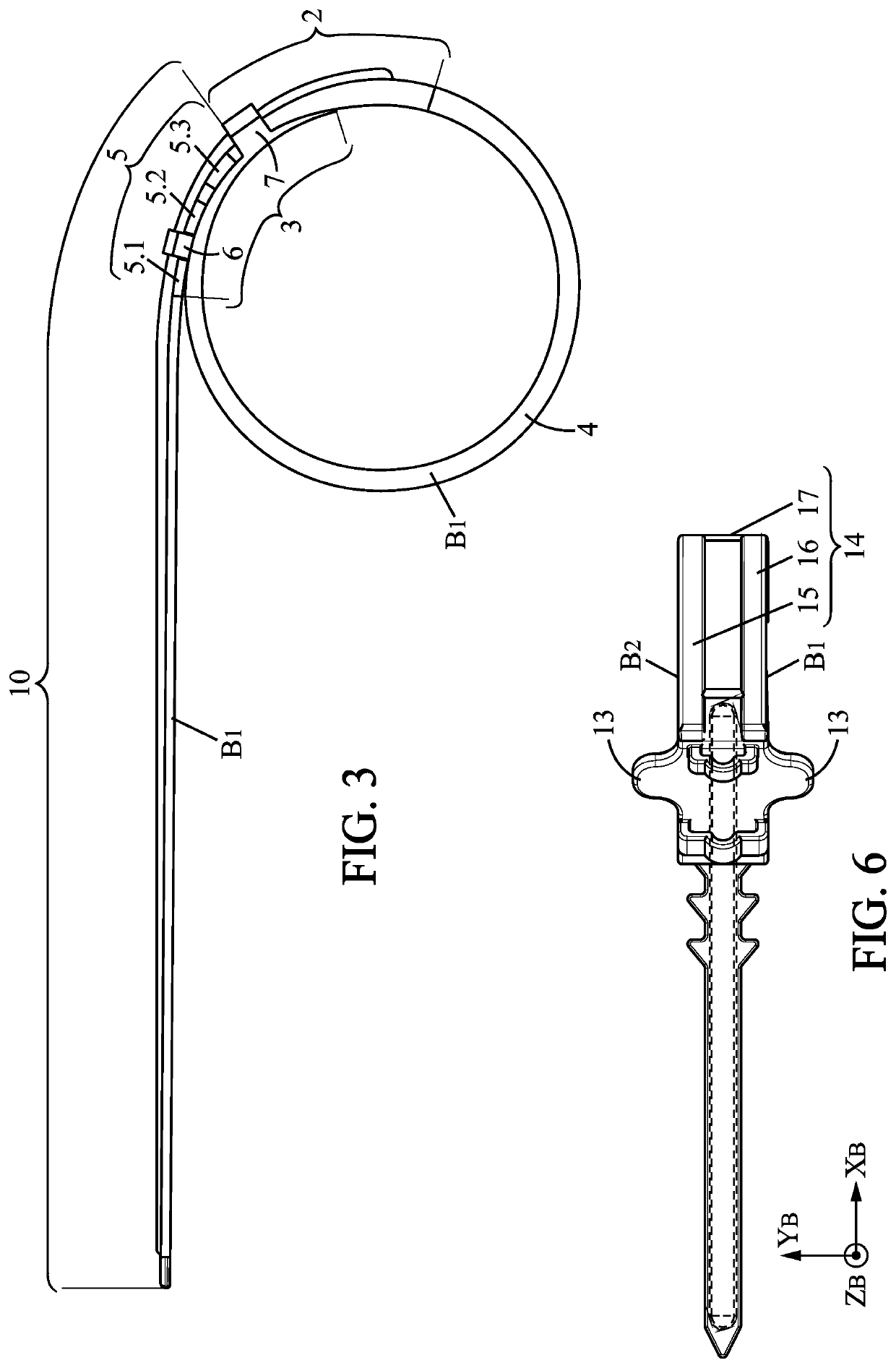 Gastric calibration band