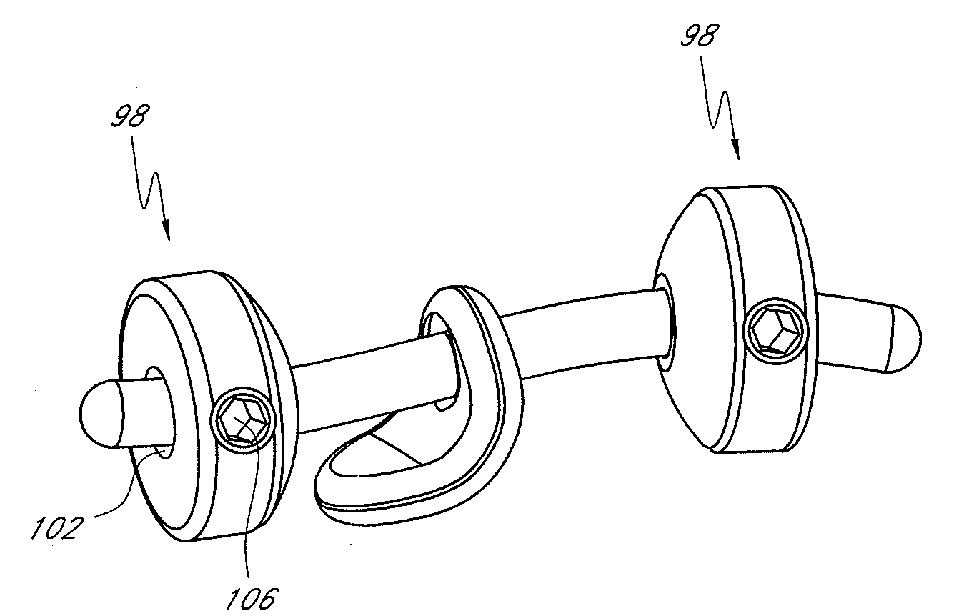 Vertebral facet joint prosthesis and method of fixation