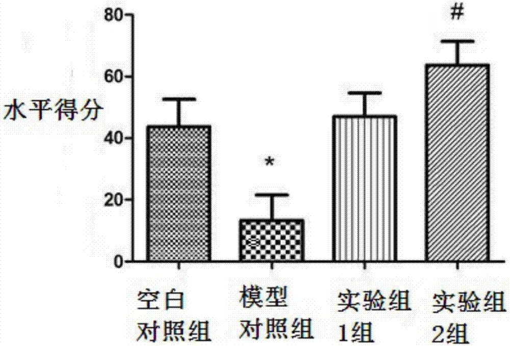 Application of NADPH in preparation of anti-anxiety drugs