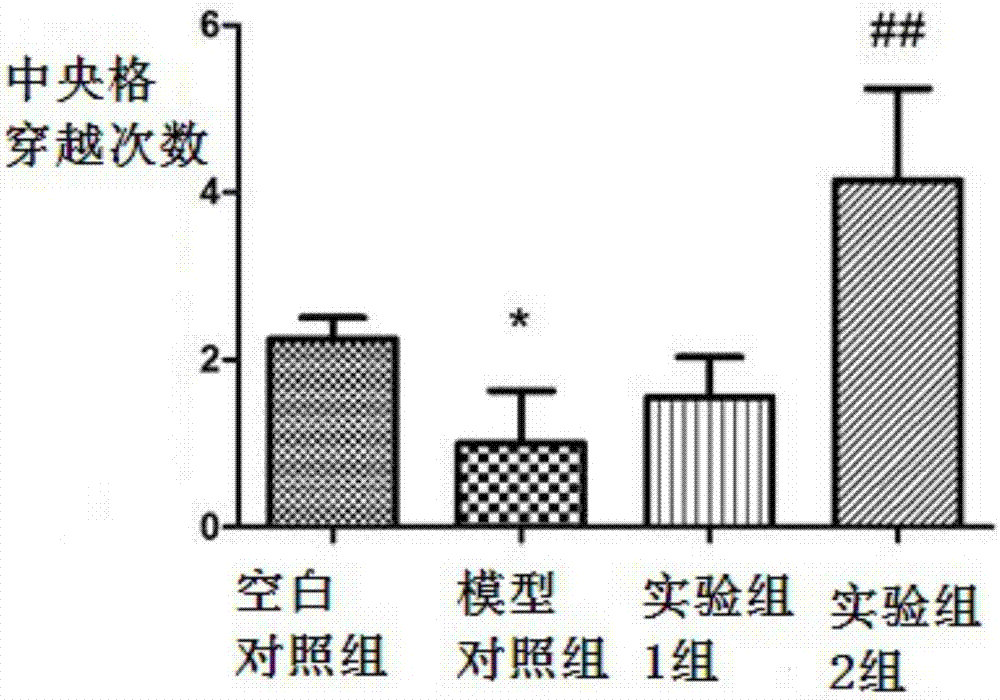 Application of NADPH in preparation of anti-anxiety drugs