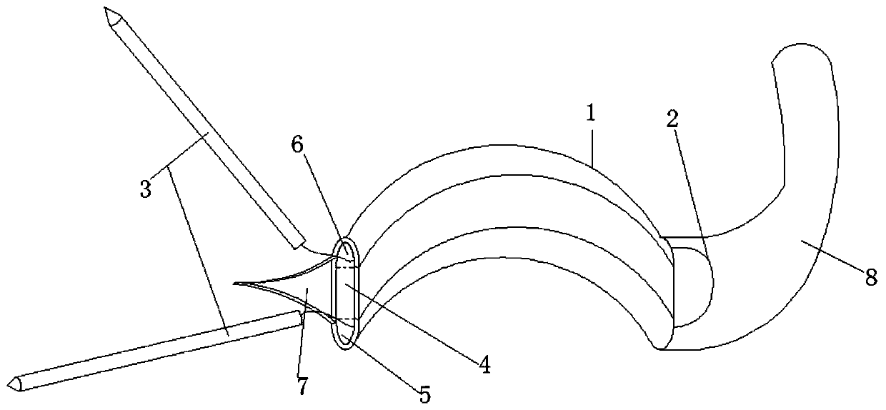 A suturing method for meniscal body and anterior horn tear