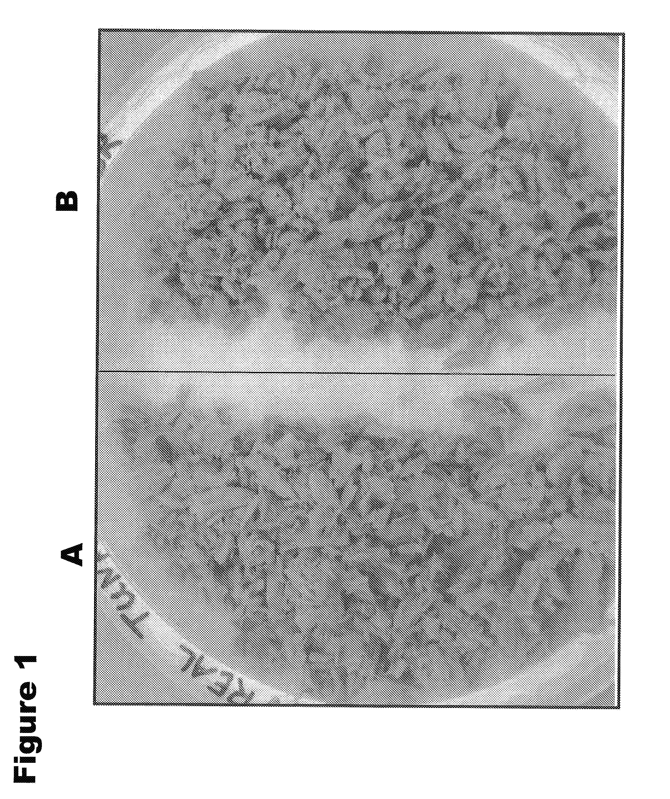 Retorted Fish Compositions and Simulated Fish Compositions Comprising Structured Plant Protein Products