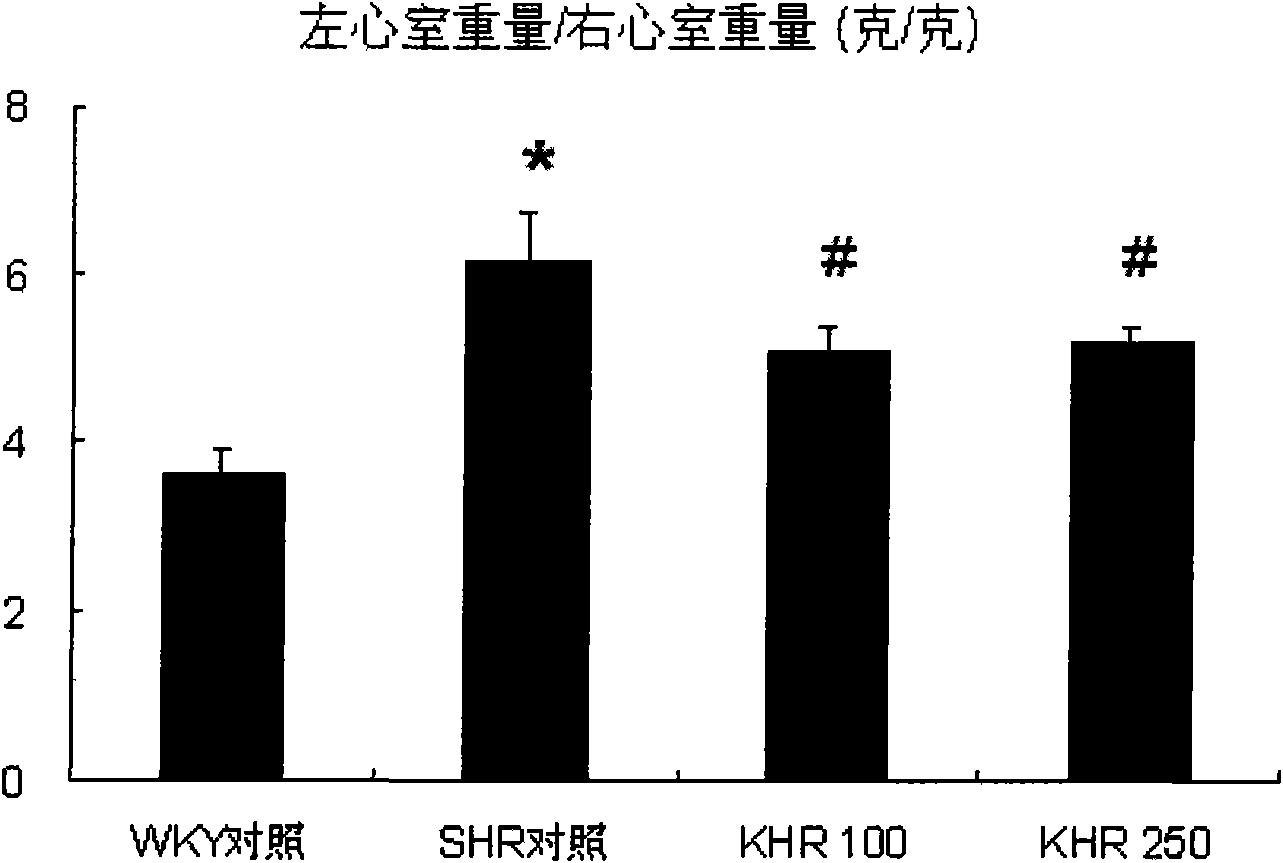 Uncaria extract and application thereof in preparing medicines for reducing blood fat and resisting cardiac hypertrophy