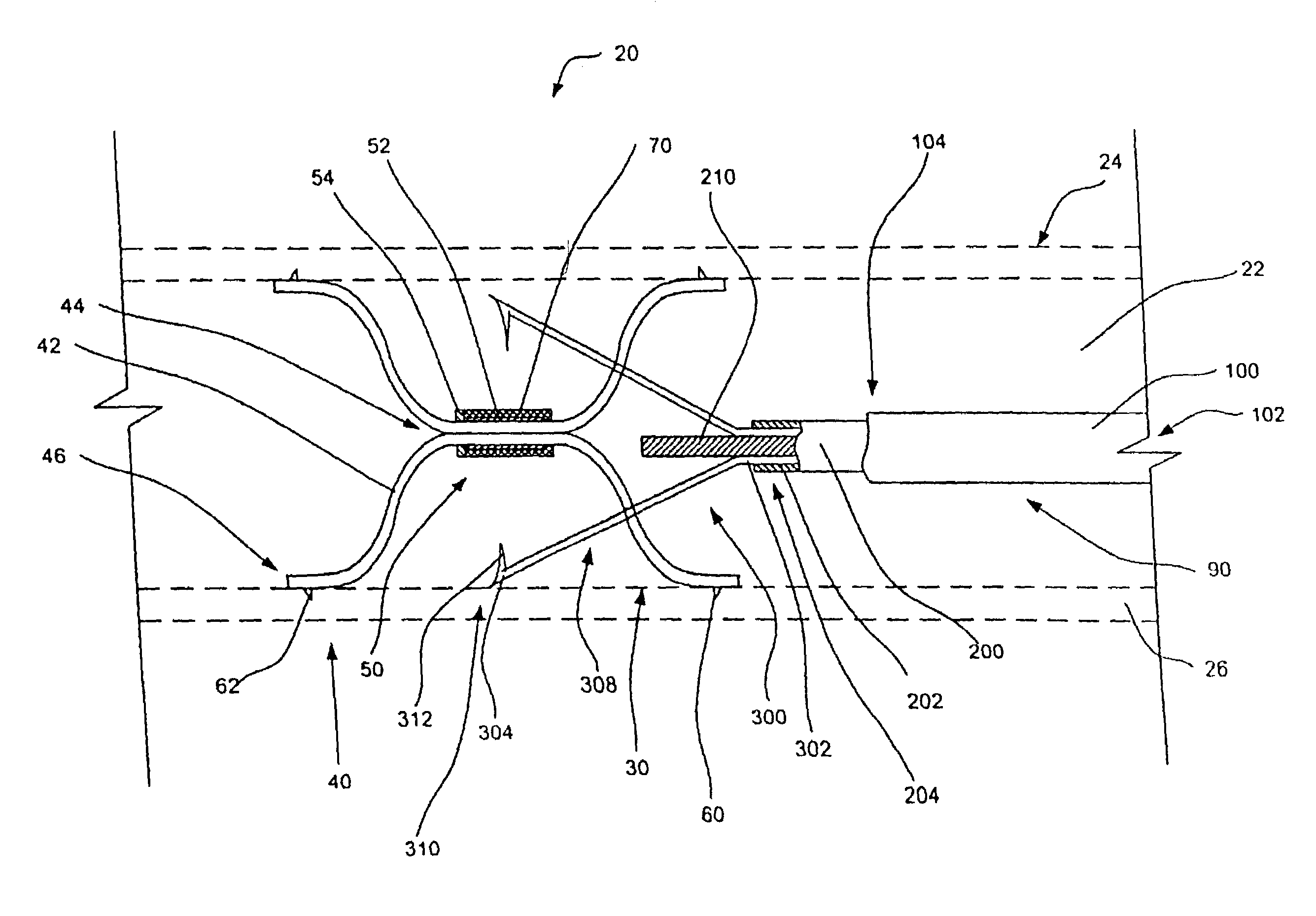 Intravascular filter retrieval device and method