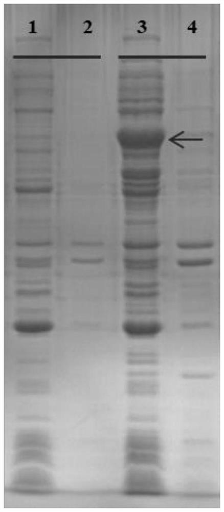 Preparation method of decarboxylase and 5-hydroxytryptamine