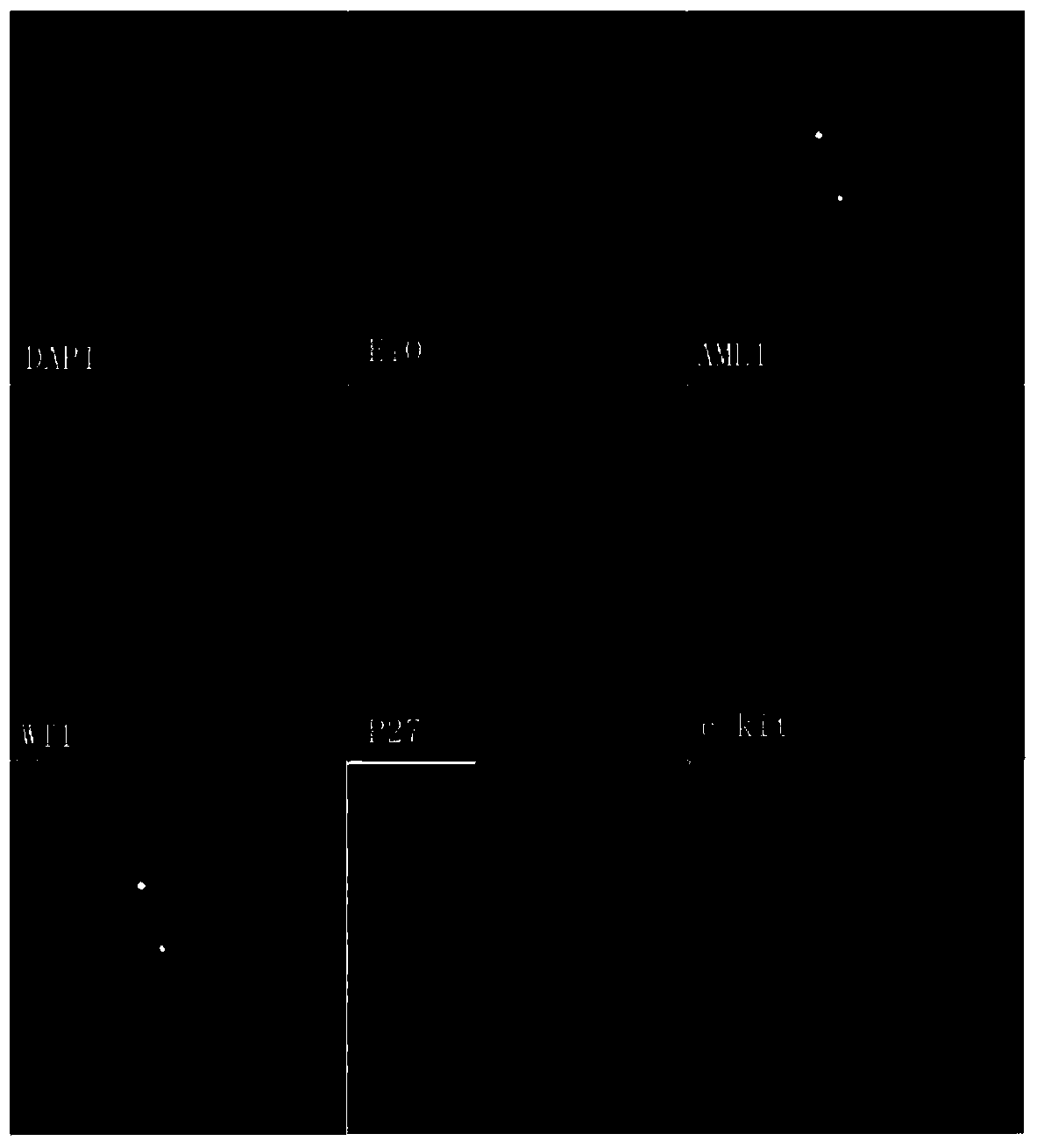 Probe kit for detecting target gene copy-number alteration in t(8;21) AML