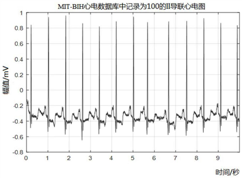 Electrocardio feature extraction method, system and device based on wavelet transform and medium