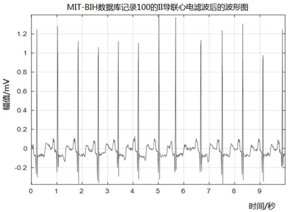 Electrocardio feature extraction method, system and device based on wavelet transform and medium