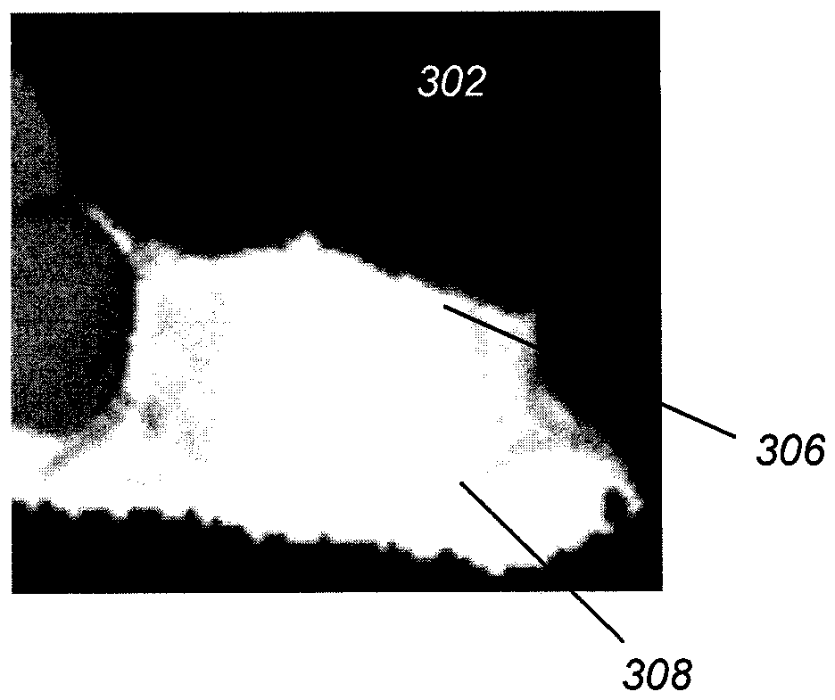 Method and system for braces removal from dentition mesh