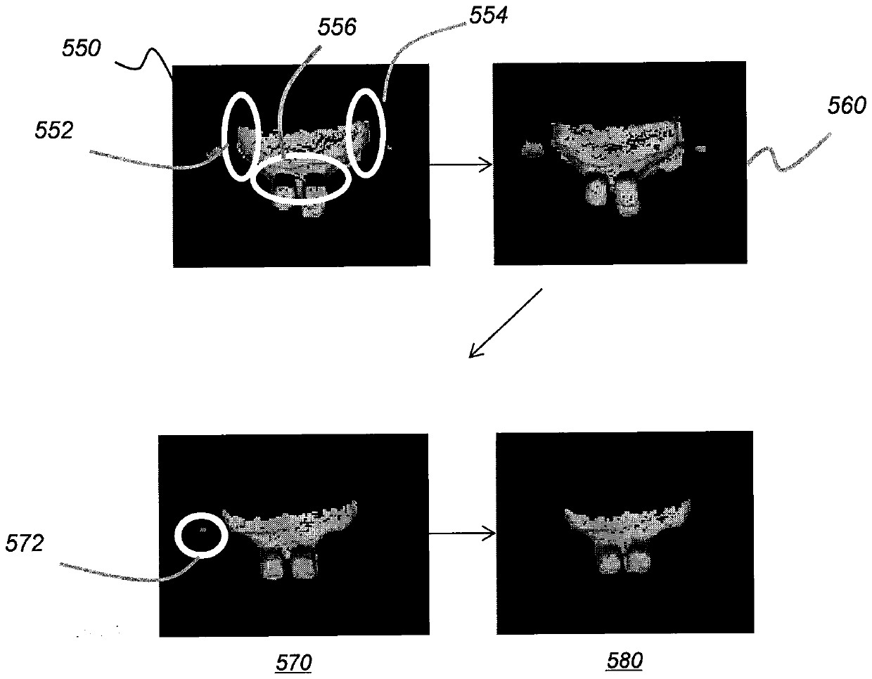 Method and system for braces removal from dentition mesh