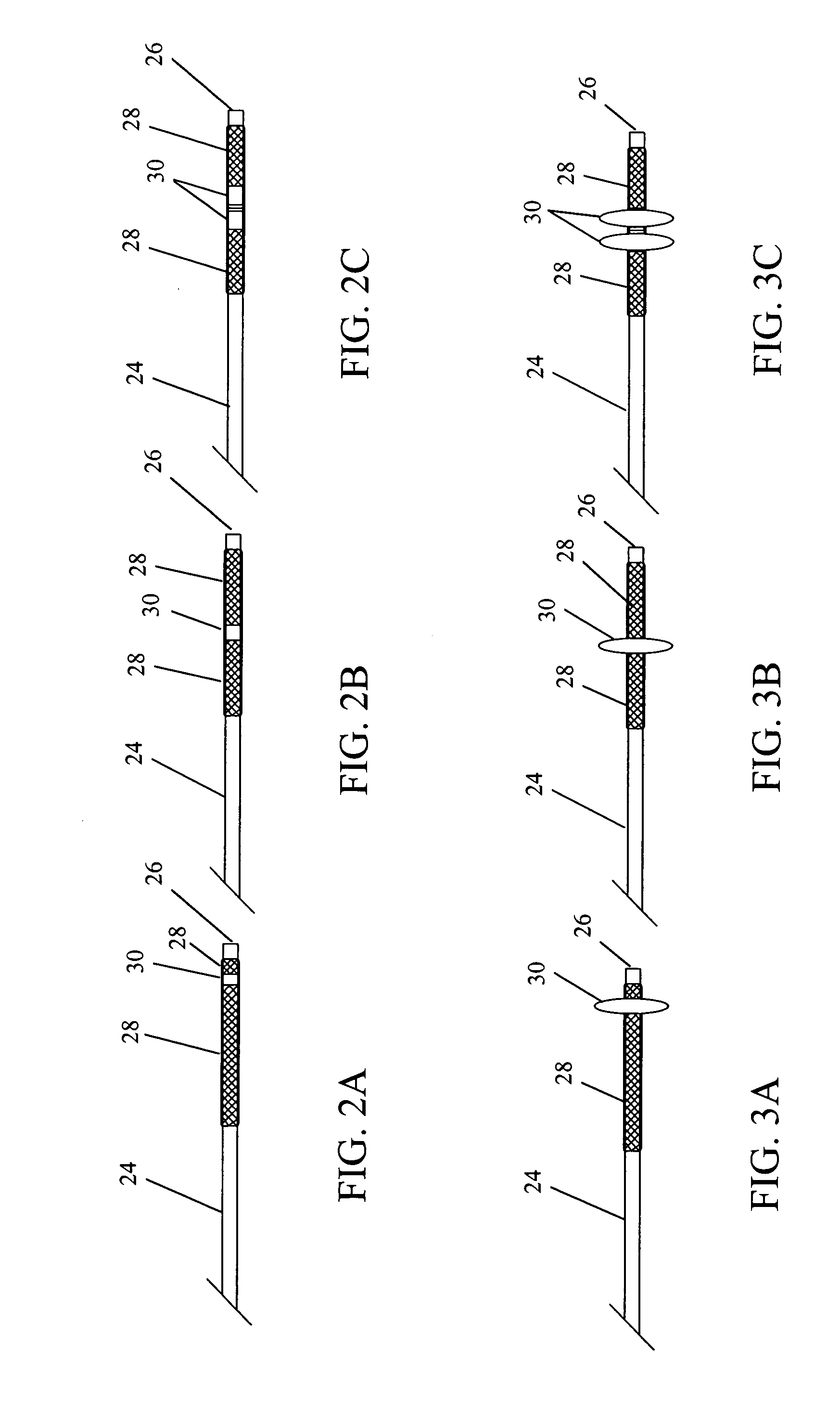 Devices and methods for disruption and removal of luminal occlusions