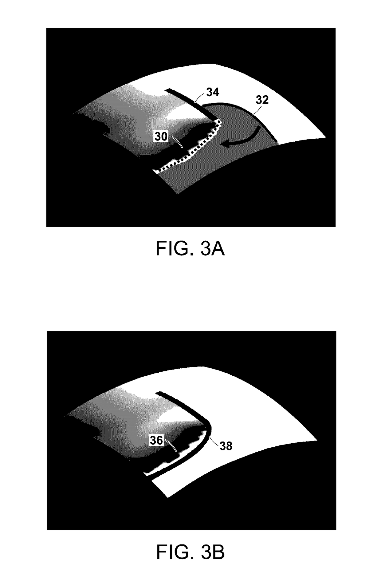 Catheters, systems, and related methods for mapping, minimizing, and treating cardiac fibrillation