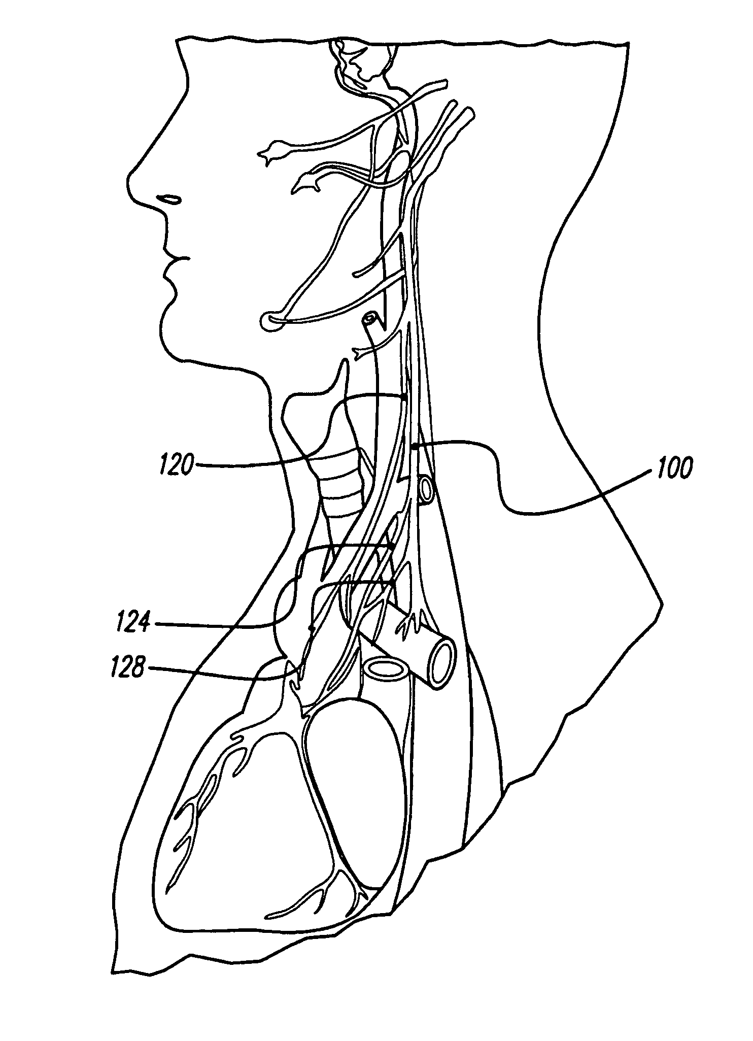 Treatment of movement disorders with drug therapy