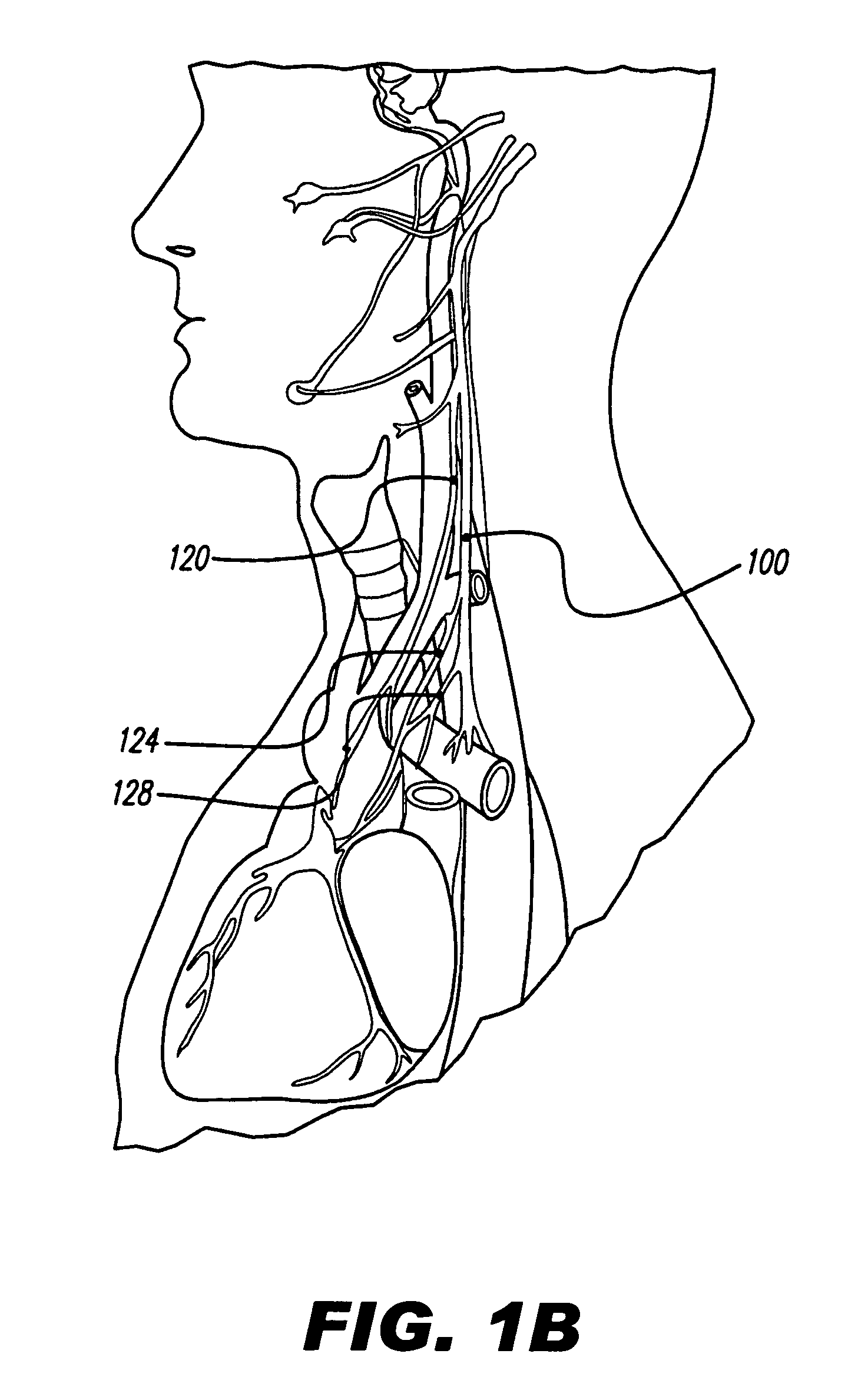 Treatment of movement disorders with drug therapy