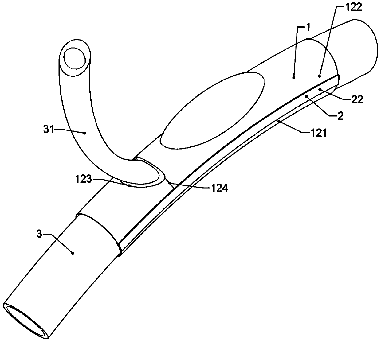 Abdominal artery remodeling device