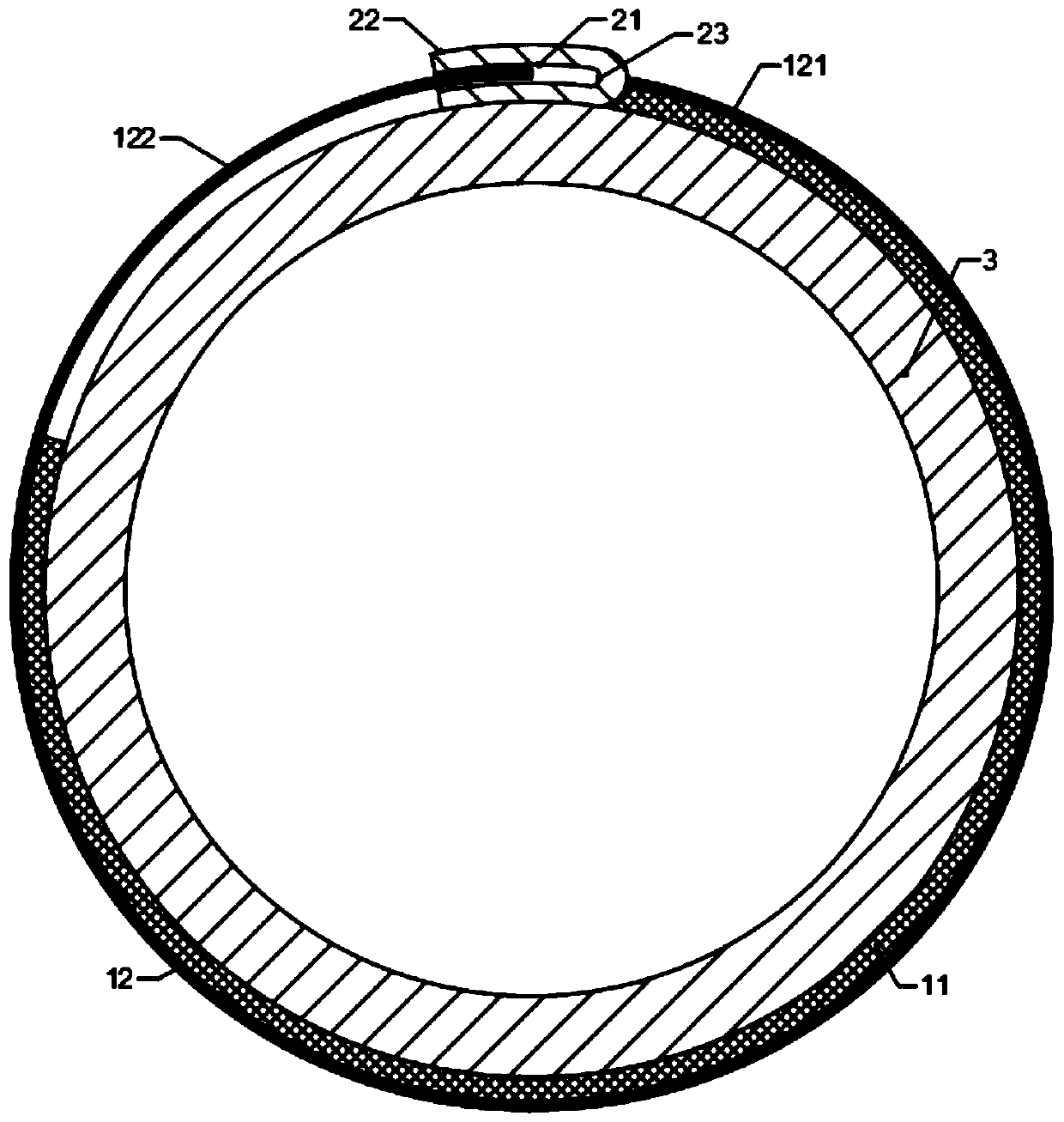 Abdominal artery remodeling device