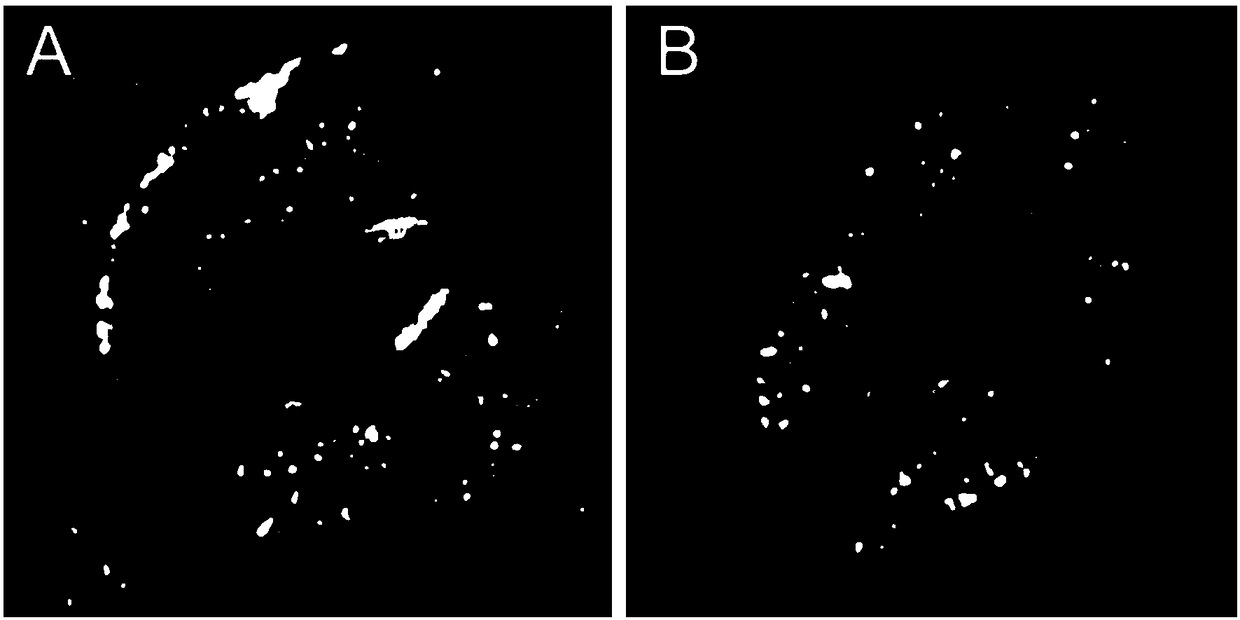 Method for observing distribution and dynamic states of proteins on stomatal guard cell membrane at single-molecule level