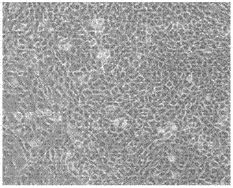 A kind of in vitro culture method of mouse fallopian tube epithelial cells