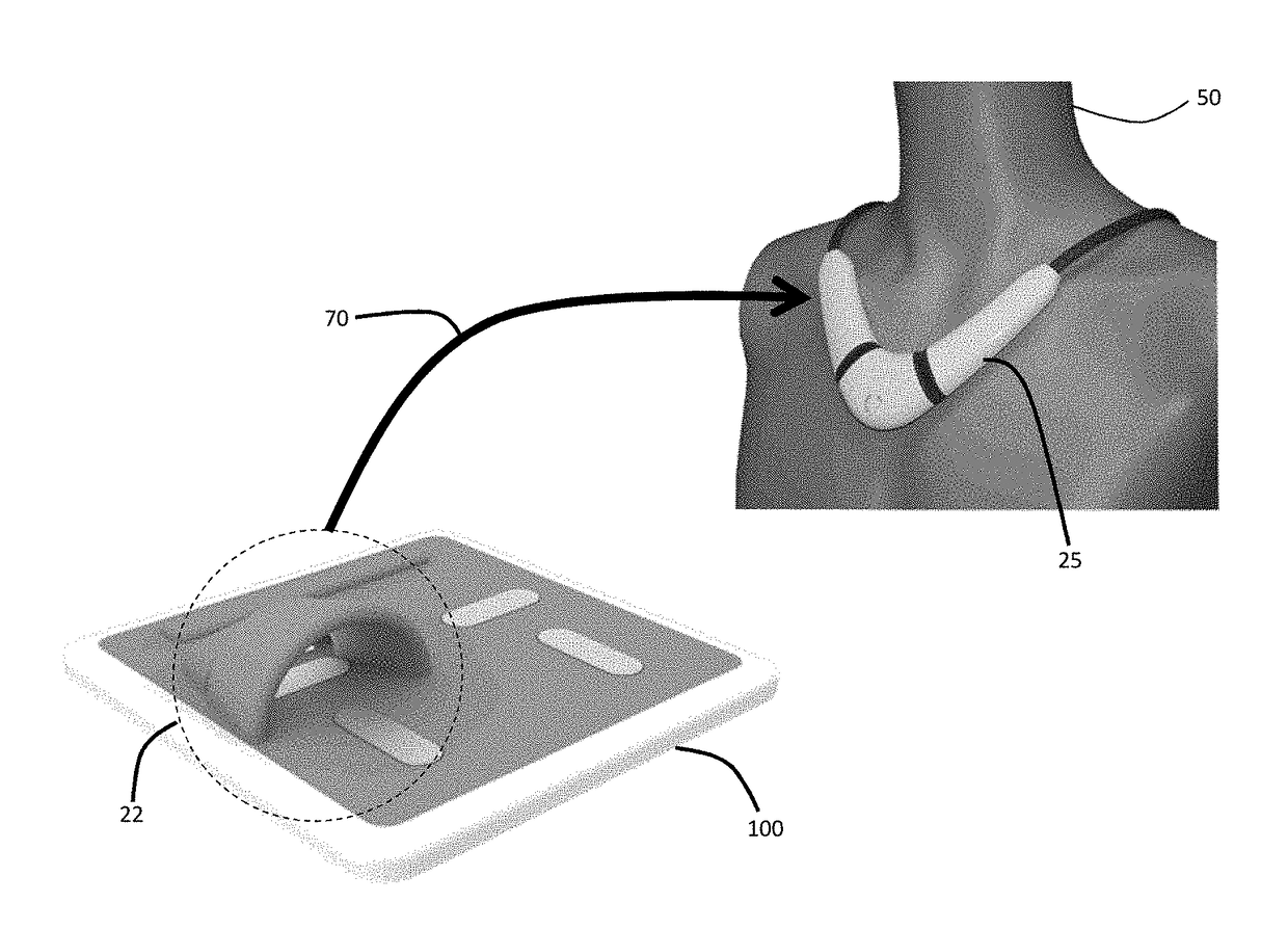 Combined floormat and body-worn physiological sensors