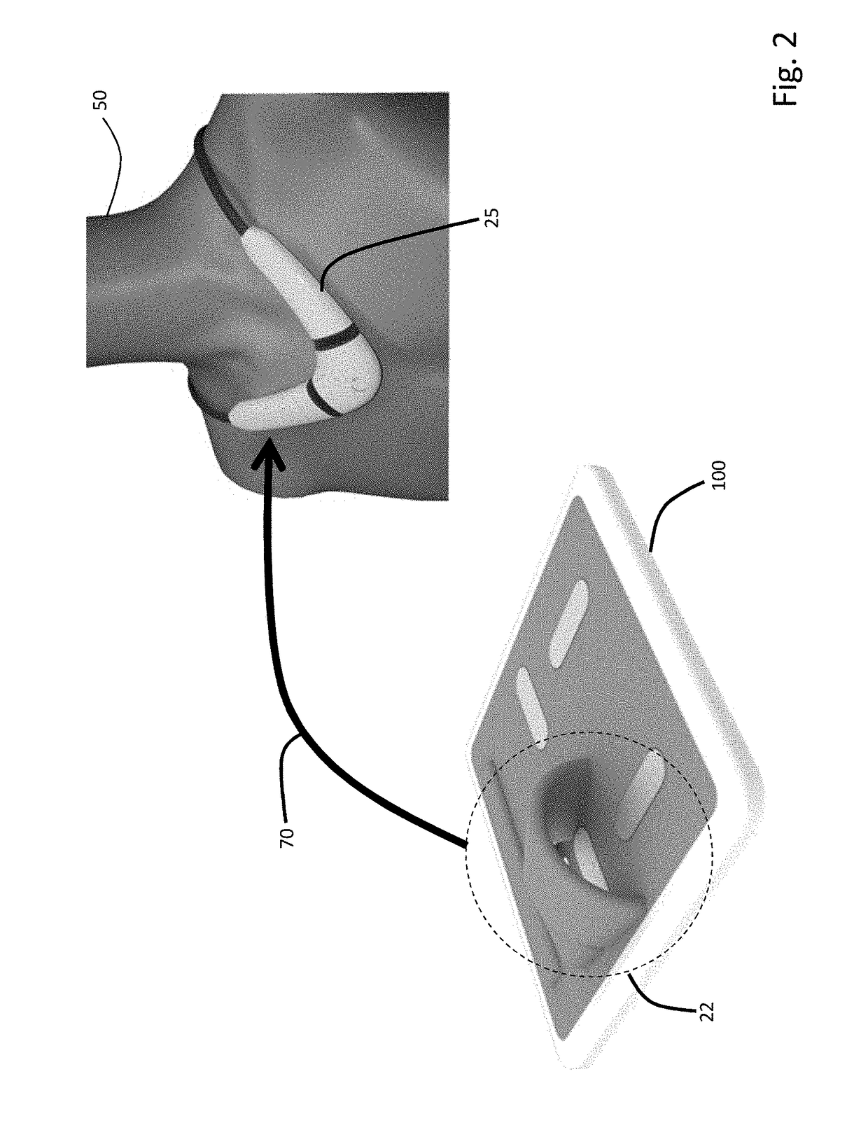 Combined floormat and body-worn physiological sensors