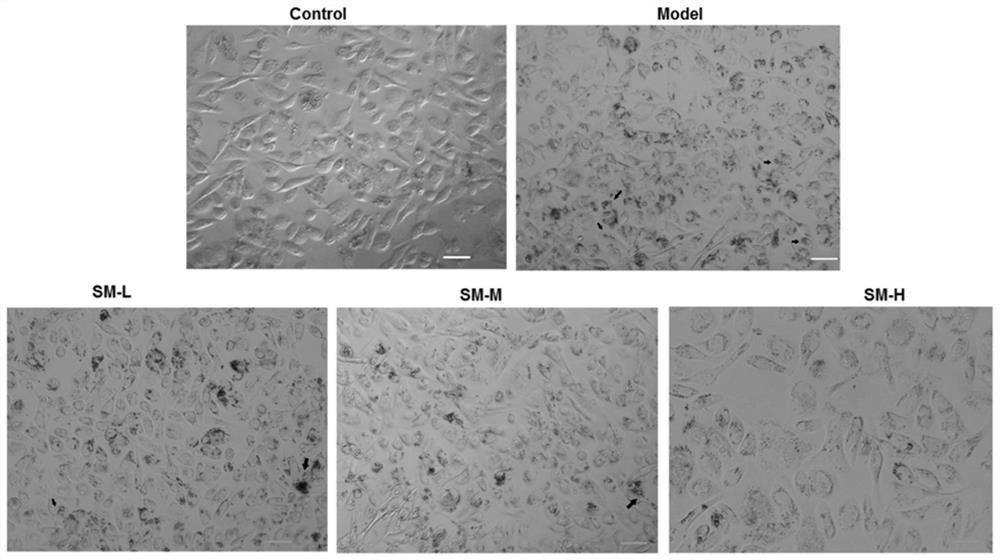 Medicine for treating renal tubule injury and application of medicine