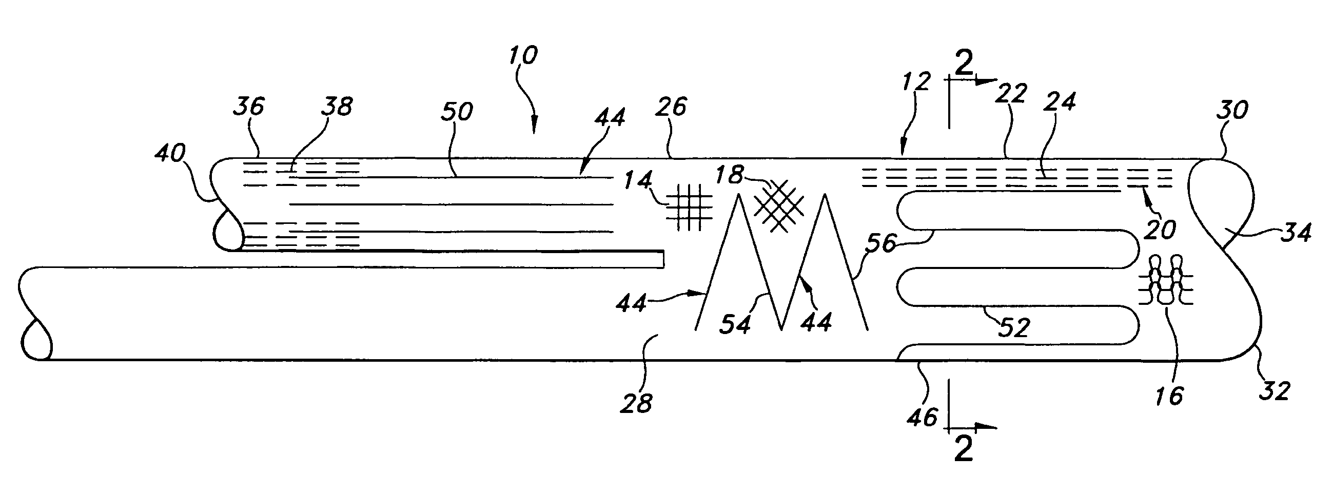 Hybrid vascular graft reinforcement