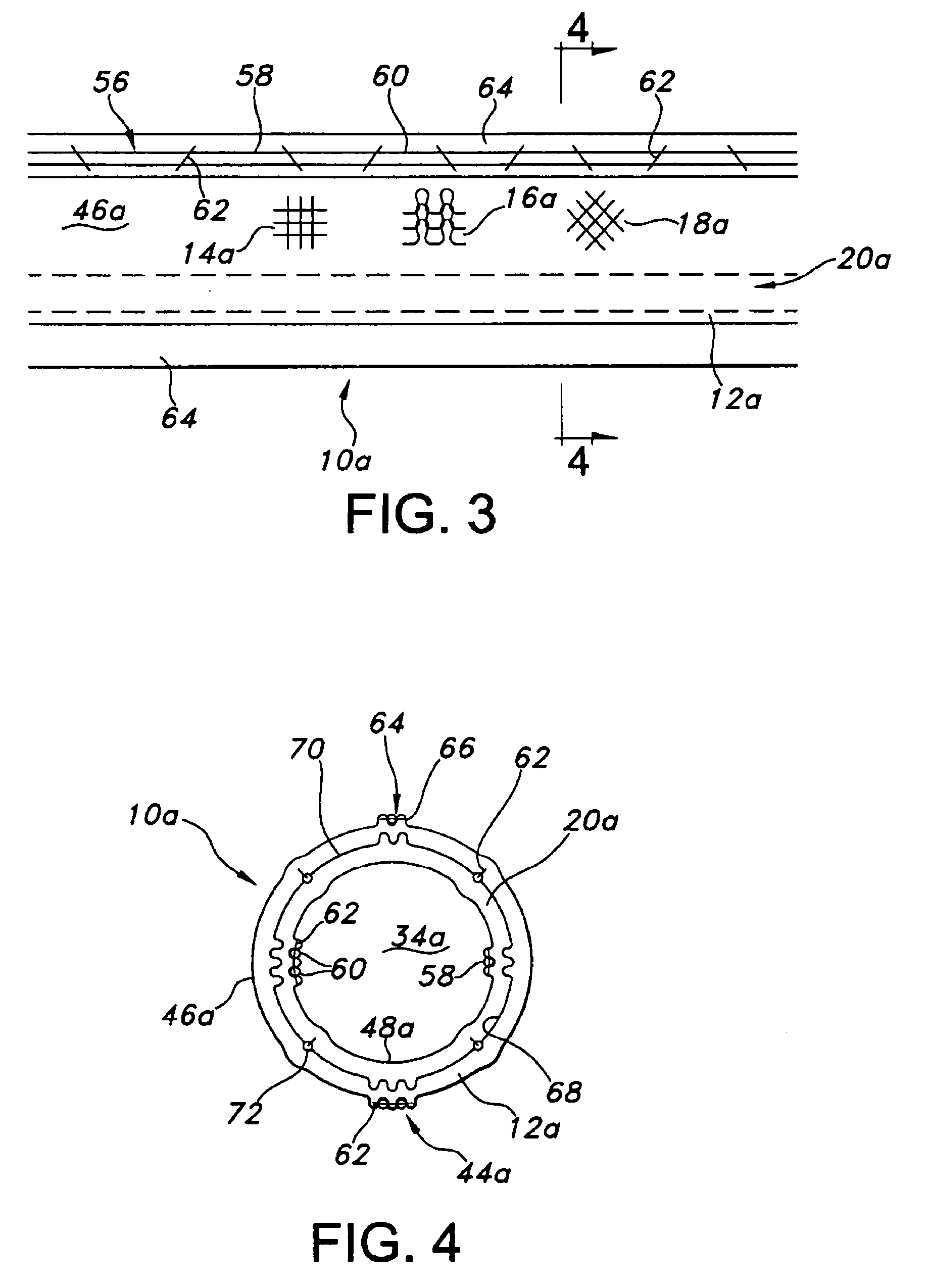 Hybrid vascular graft reinforcement