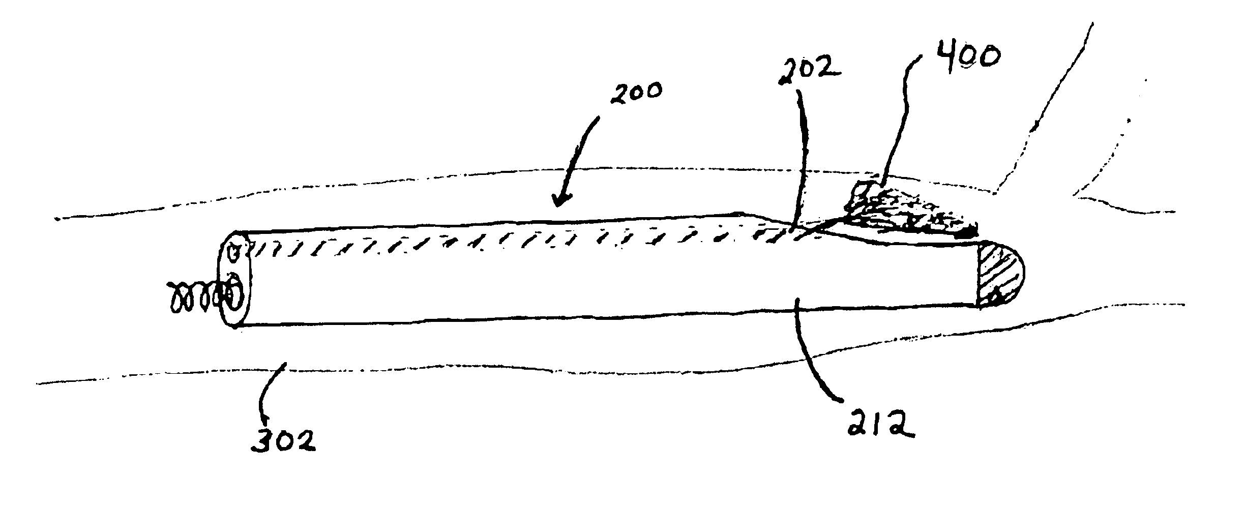 Method and apparatus for placing a coronary sinus/cardiac vein pacing lead using a multi-purpose side lumen