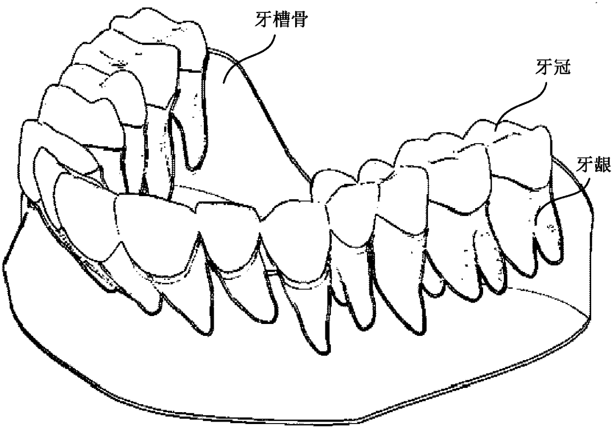 Method for digitally simulating orthodontic effect of dental appliance