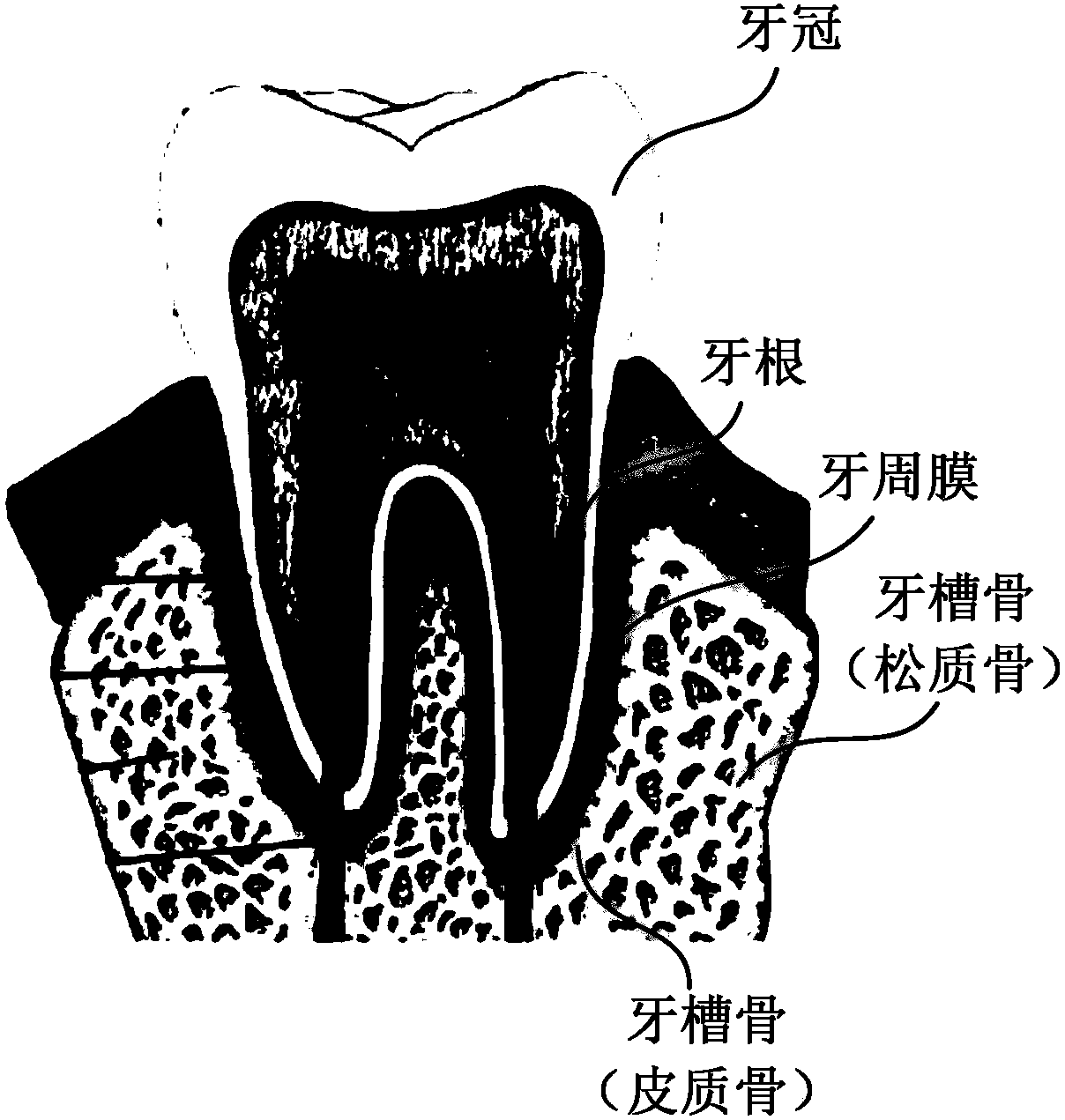 Method for digitally simulating orthodontic effect of dental appliance