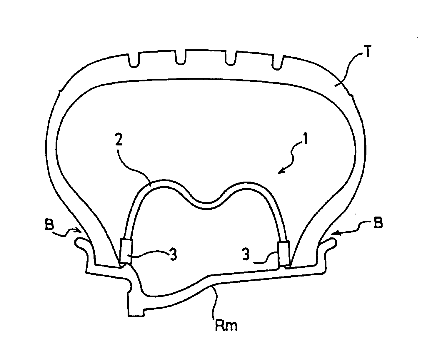 Run-Flat Supporting Body and Tire/Wheel Assembly