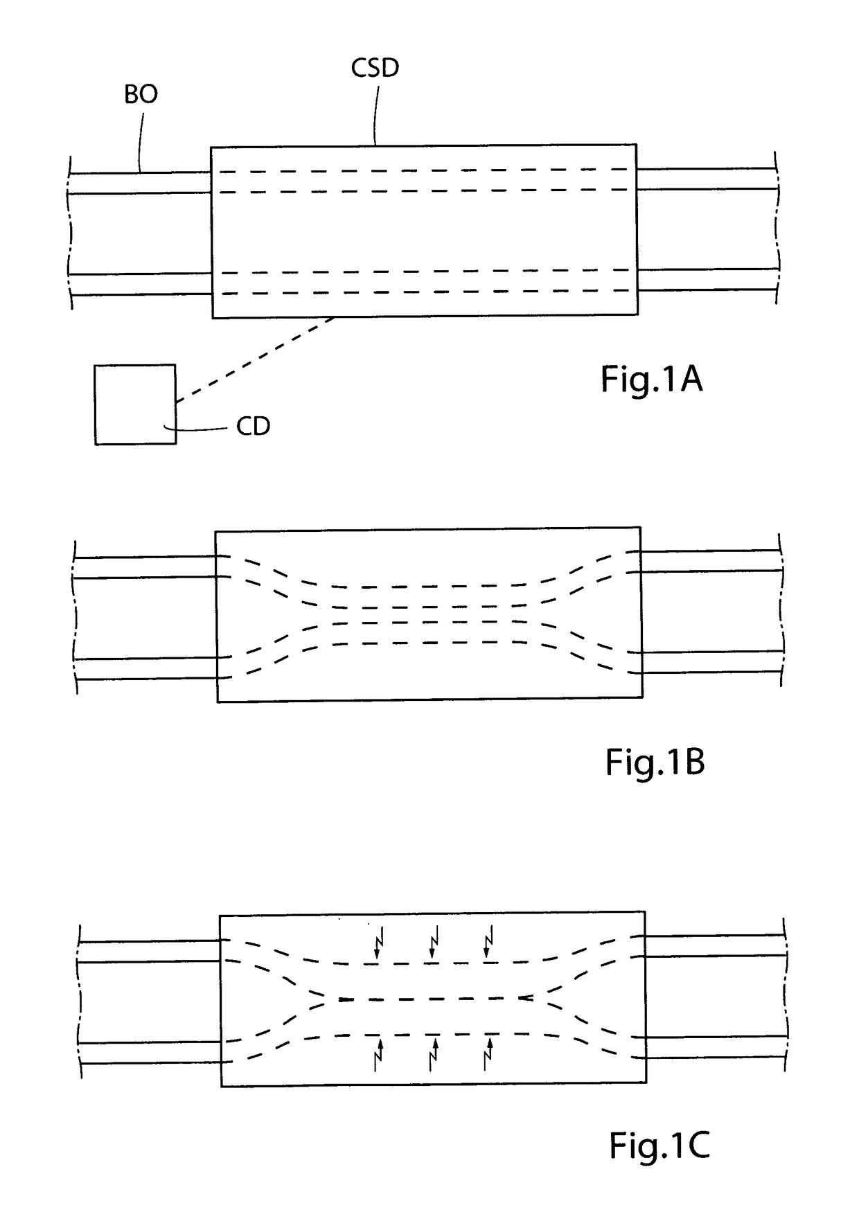 Method for controlling flow in a bodily organ