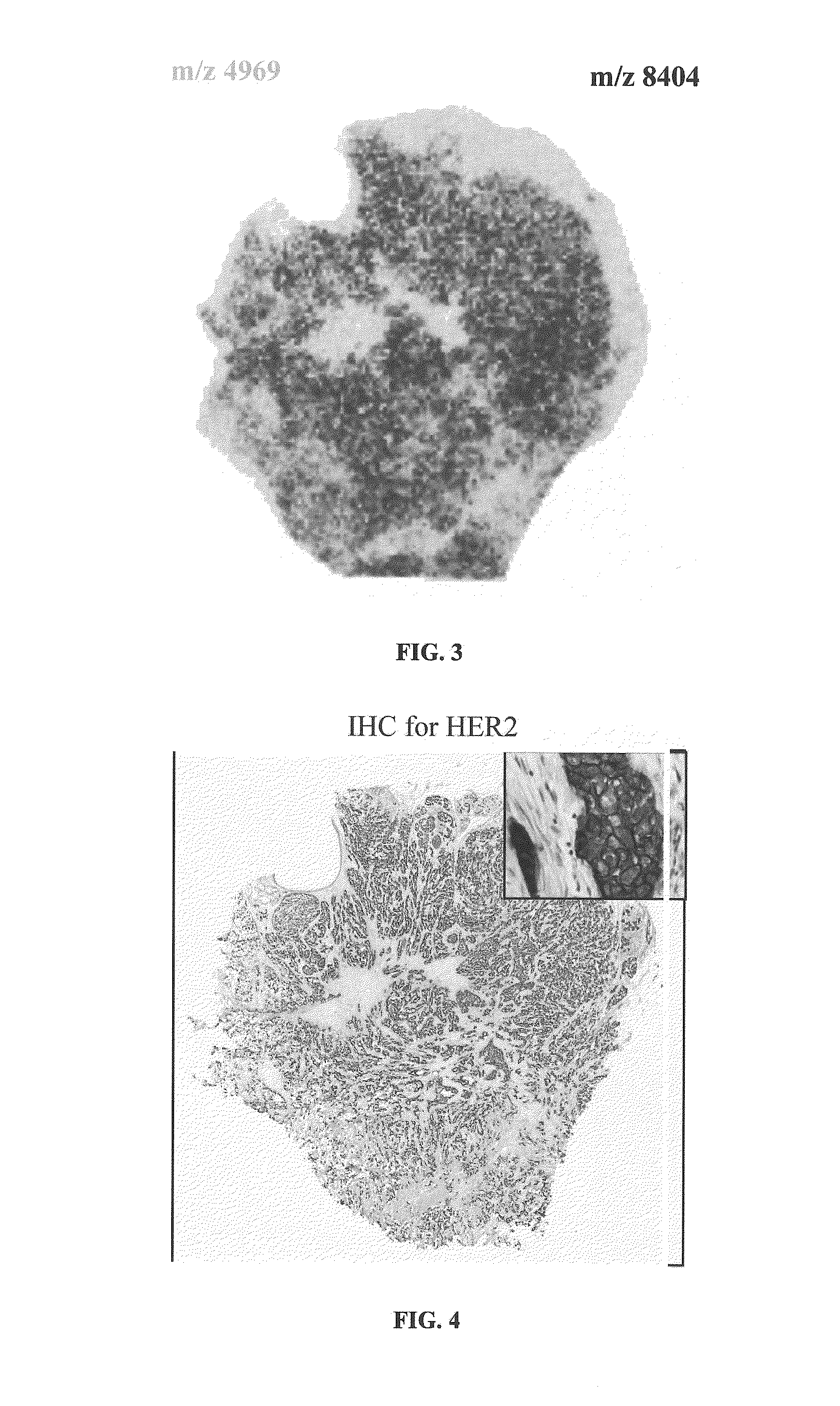 Determining an expression status of human epidermal growth factor receptor 2 (HER2) in a biological sample