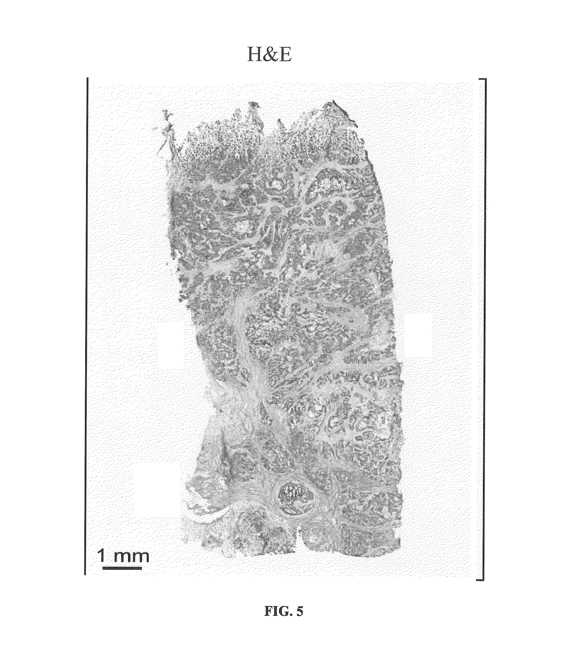 Determining an expression status of human epidermal growth factor receptor 2 (HER2) in a biological sample