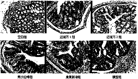 Traditional Chinese medicine composition for preventing or treating ulcerative colitis canceration