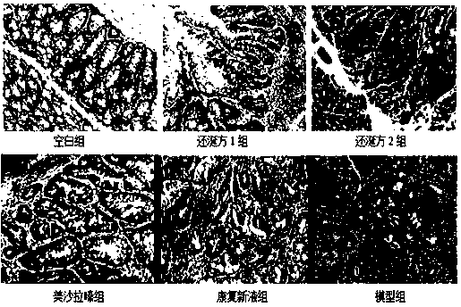 Traditional Chinese medicine composition for preventing or treating ulcerative colitis canceration