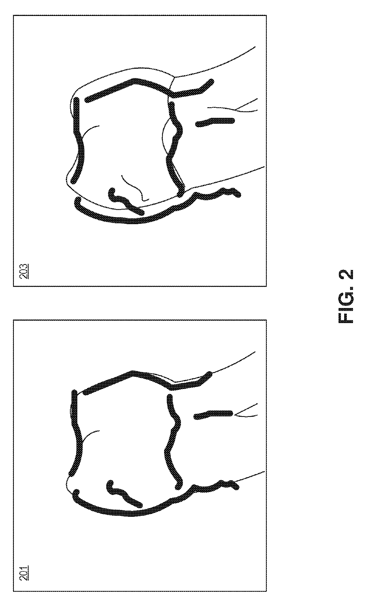 System and method for ranking bacterial activity leading to tooth and gum disease