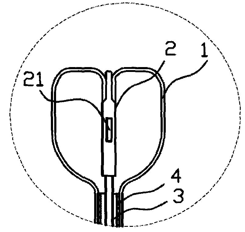 Novel intraluminal tumor cryosurgery ablation catheter and operation method thereof