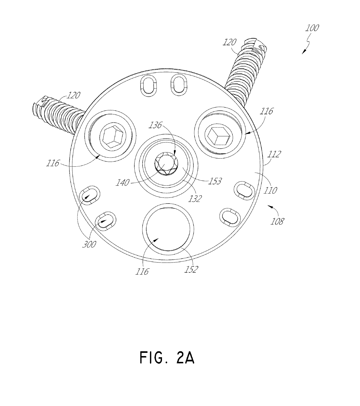 Stemless shoulder implant with fixation components