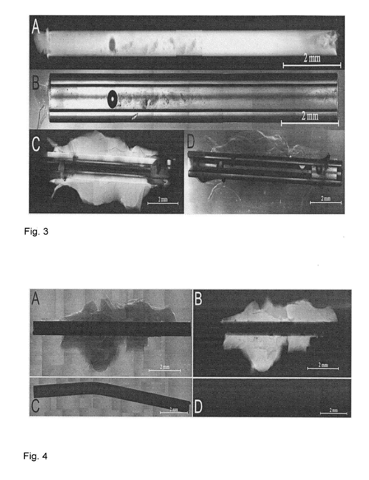 Intraocular device and method for preparing the same