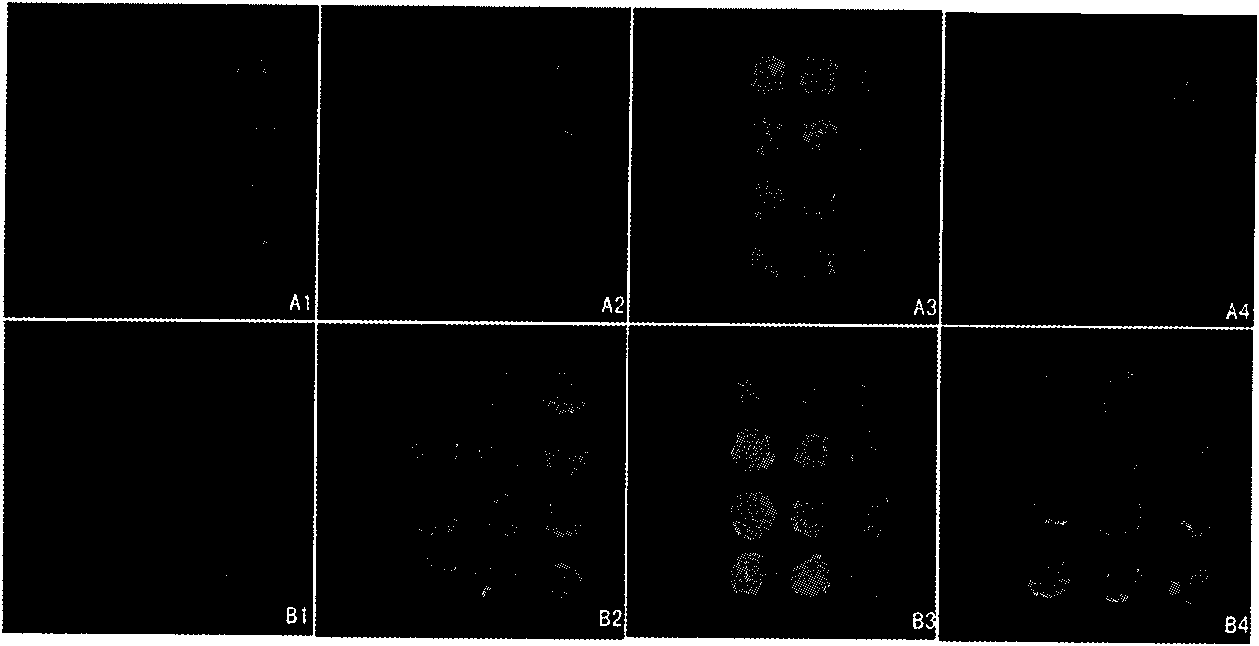 Fish lymphocystis disease virus (LCDV) immunity detection chip and preparation method and application thereof