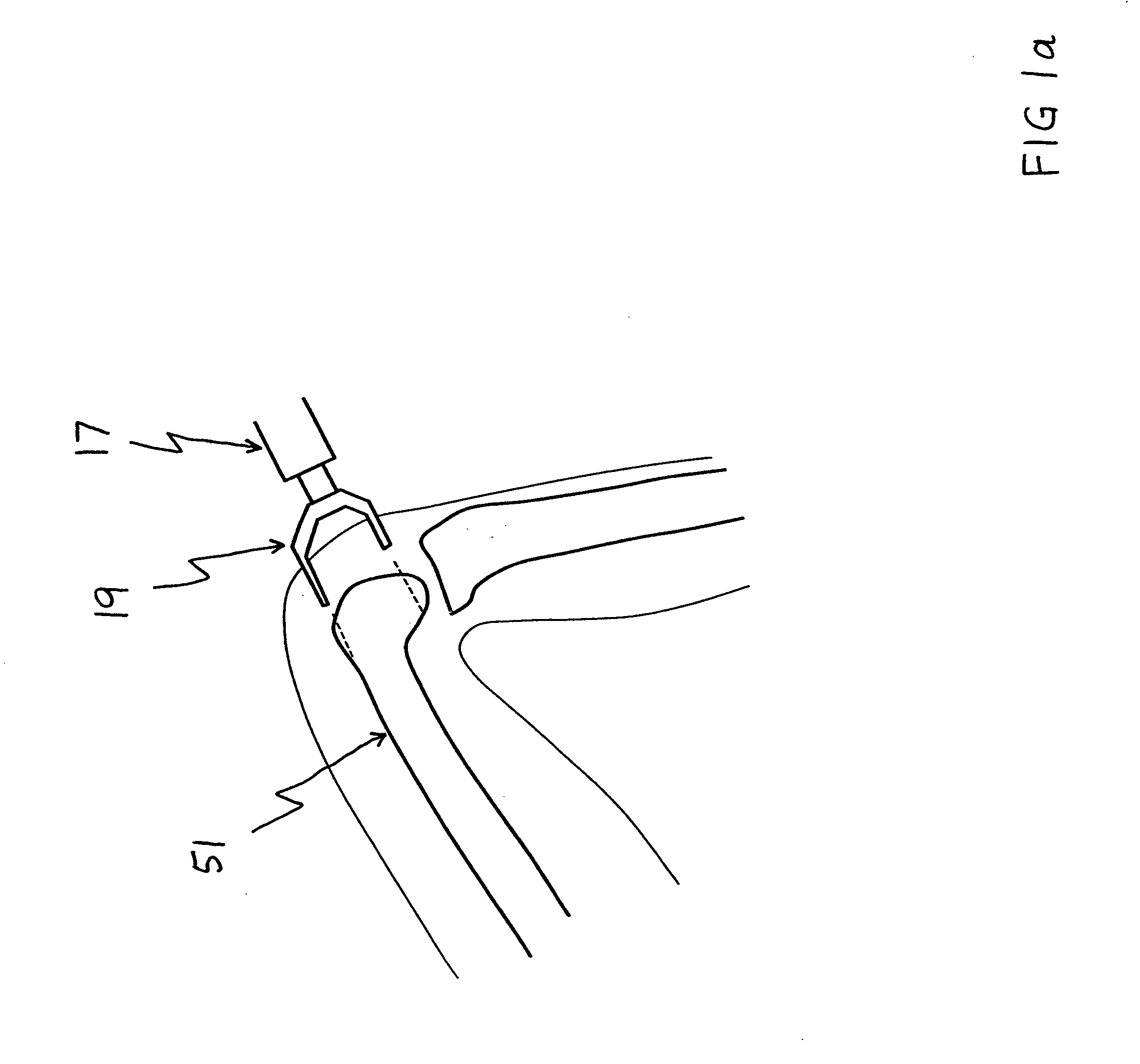 Bone shaping device for knee replacement