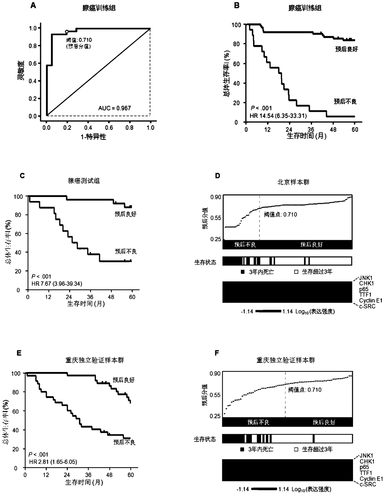 A system for predicting the prognosis of patients with lung adenocarcinoma and judging the benefit of adjuvant chemotherapy