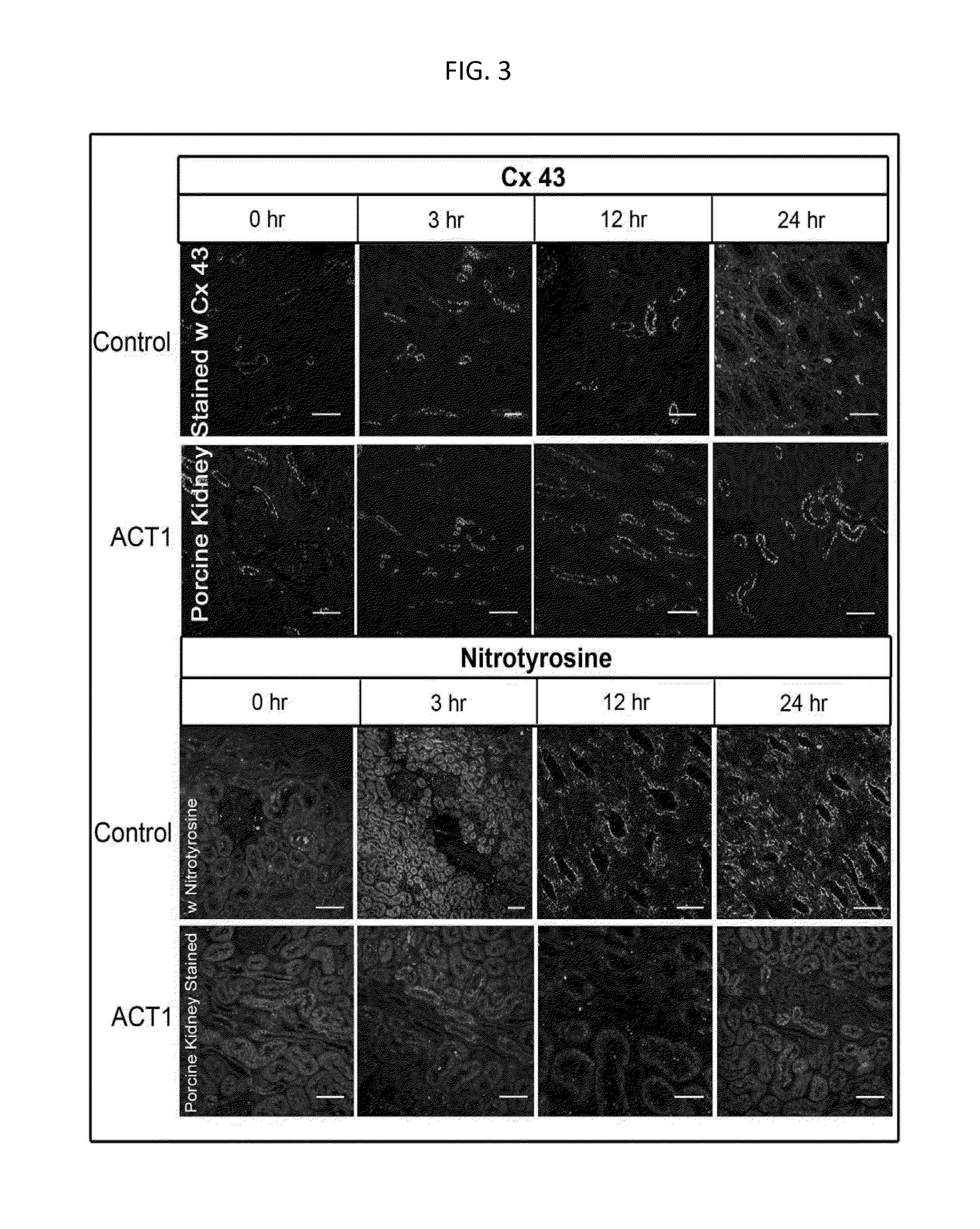 Alpha Connexin c-Terminal (ACT) peptides for use in transplant