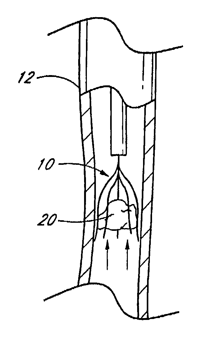 Vascular Filter Device