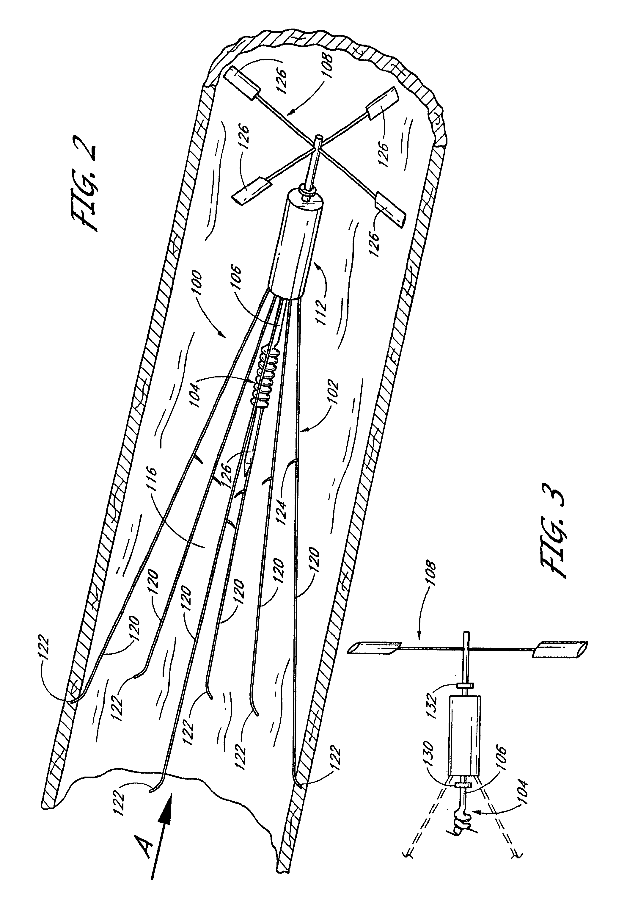 Vascular Filter Device